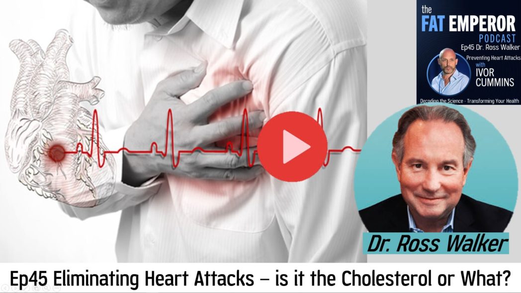 Ep45 Eliminating Heart Attacks – is it the Cholesterol or What?